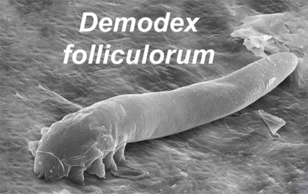 Demodex Folliculorum