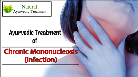 Chronic Mononucleosis