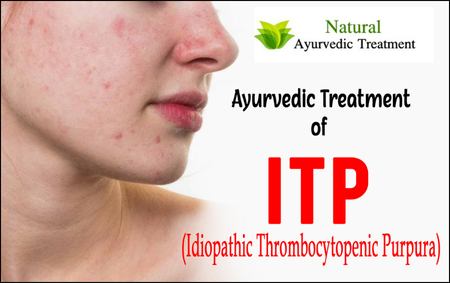 ITP (Idiopathic Thrombocytopenic Purpura)