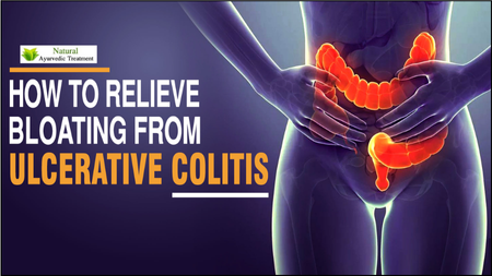 Ulcerative Colitis