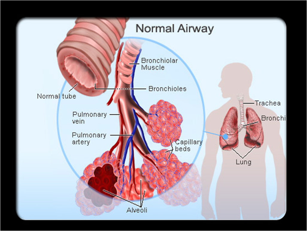 natural treatment for asthma