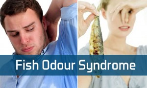 Fish odor syndrome что это